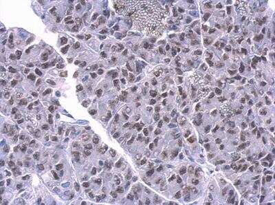 Immunohistochemistry-Paraffin: PUF60 Antibody (677) [NBP2-43836]
