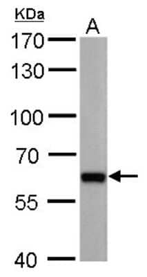 Western Blot: PUF60 Antibody (677) [NBP2-43836]