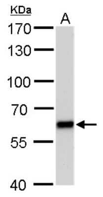 Western Blot: PUF60 Antibody (677) [NBP2-43836]