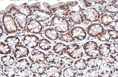 Immunohistochemistry-Paraffin: PUF60 Antibody (917) [NBP2-43764]