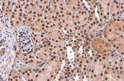 Immunohistochemistry-Paraffin: PUF60 Antibody (917) [NBP2-43764]