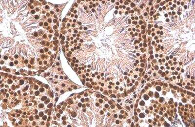 Immunohistochemistry-Paraffin: PUF60 Antibody (917) [NBP2-43764]