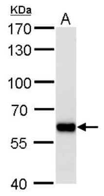 Western Blot: PUF60 Antibody (917) [NBP2-43764]