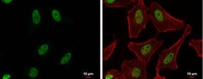 Immunocytochemistry/ Immunofluorescence: PUF60 Antibody [NBP2-20007]