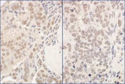 Immunohistochemistry-Paraffin: PUF60 Antibody [NBP1-49906]