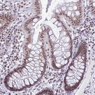 Immunohistochemistry: PUF60 Antibody [NBP2-49032]