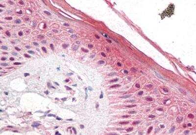 Immunohistochemistry-Paraffin: PUF60 Antibody [NB100-1125]