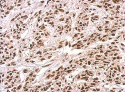 Immunohistochemistry-Paraffin: PUF60 Antibody [NBP2-20007]