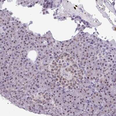 Immunohistochemistry-Paraffin: PUF60 Antibody [NBP2-49032]