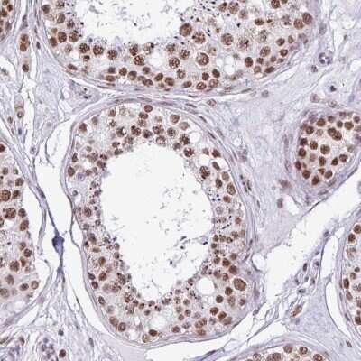 Immunohistochemistry-Paraffin: PUF60 Antibody [NBP2-49032]