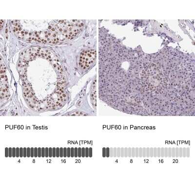 Immunohistochemistry-Paraffin: PUF60 Antibody [NBP2-49032]
