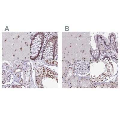 Immunohistochemistry-Paraffin: PUF60 Antibody [NBP2-49032]
