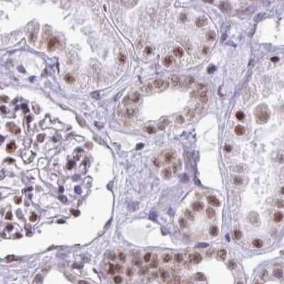 Immunohistochemistry-Paraffin: PUF60 Antibody [NBP2-49032]