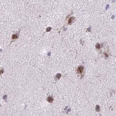Immunohistochemistry-Paraffin: PUF60 Antibody [NBP2-49032]