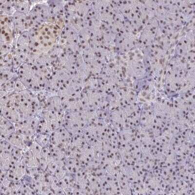 Immunohistochemistry-Paraffin: PUF60 Antibody [NBP2-49303]