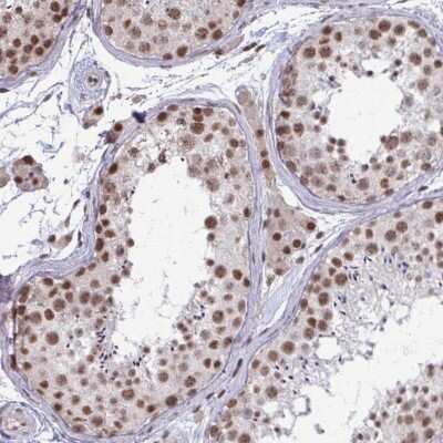 Immunohistochemistry-Paraffin: PUF60 Antibody [NBP2-49303]
