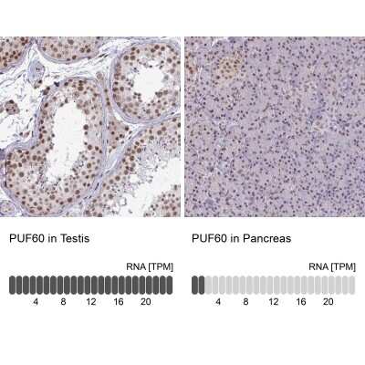 Immunohistochemistry-Paraffin: PUF60 Antibody [NBP2-49303]