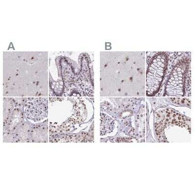 Immunohistochemistry-Paraffin: PUF60 Antibody [NBP2-49303]
