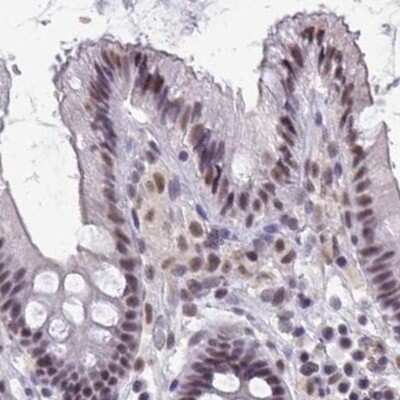 Immunohistochemistry-Paraffin: PUF60 Antibody [NBP2-49303]