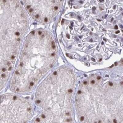 Immunohistochemistry-Paraffin: PUF60 Antibody [NBP2-49303]