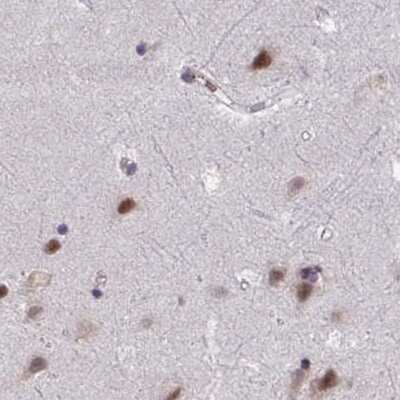 Immunohistochemistry-Paraffin: PUF60 Antibody [NBP2-49303]