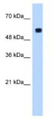 Western Blot: PUF60 Antibody [NBP1-57427]