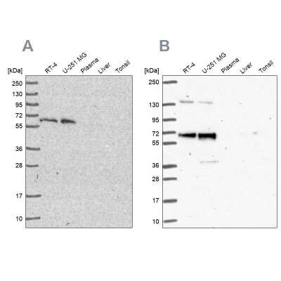 Western Blot: PUF60 Antibody [NBP2-49032]