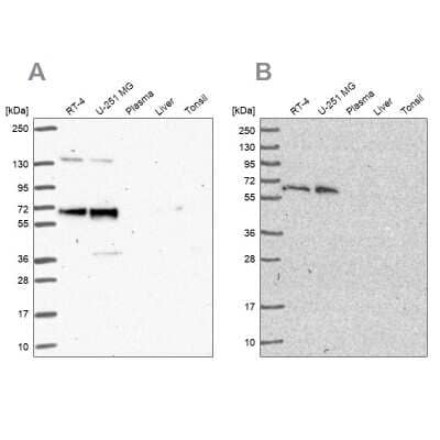 Western Blot: PUF60 Antibody [NBP2-49303]