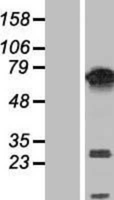 Western Blot: PUF60 Overexpression Lysate [NBP2-05786]