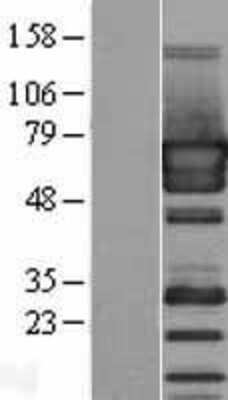 Western Blot: PUF60 Overexpression Lysate [NBP2-07361]