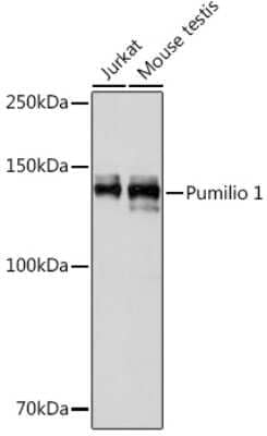 Western Blot: PUM1 Antibody (8Y6H5) [NBP3-15279]