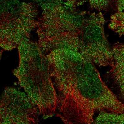 Immunocytochemistry/ Immunofluorescence: PUM1 Antibody [NBP2-58337]
