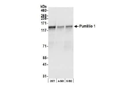 Western Blot: PUM1 Antibody [NB100-259]