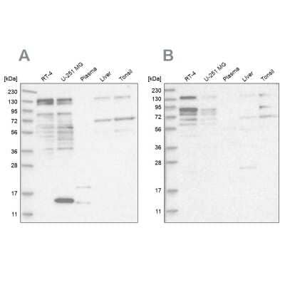 Western Blot: PUM1 Antibody [NBP1-87856]