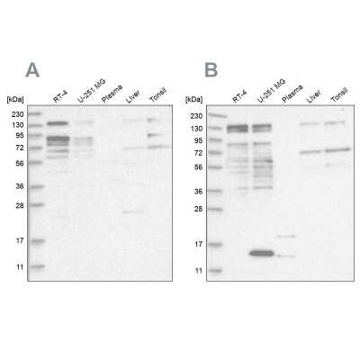 Western Blot: PUM1 Antibody [NBP2-58337]