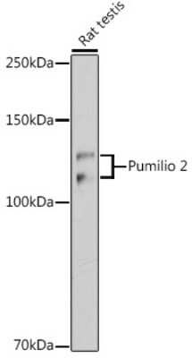 Western Blot: PUM2 Antibody (7M1B1) [NBP3-15913]