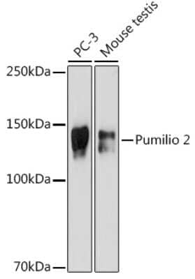 Western Blot: PUM2 Antibody (7M1B1) [NBP3-15913]
