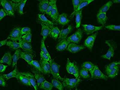 Immunocytochemistry/ Immunofluorescence: PUM2 Antibody [NBP2-97161]