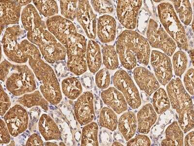 Immunohistochemistry-Paraffin: PUM2 Antibody [NBP2-98727]