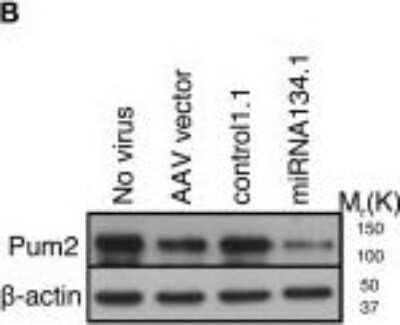 Western Blot: PUM2 Antibody [NB100-387]