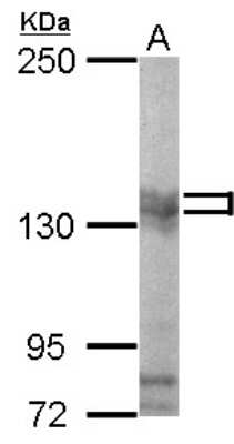 Western Blot: PUM2 Antibody [NBP2-20009]