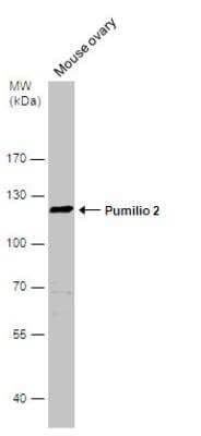 Western Blot: PUM2 Antibody [NBP2-20009]