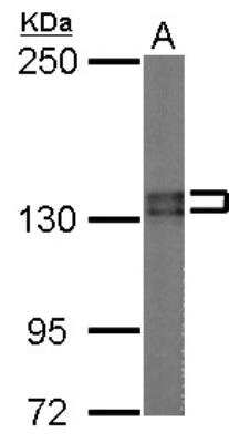 Western Blot: PUM2 Antibody [NBP2-20010]