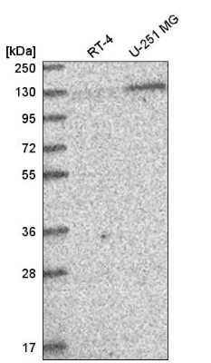 Western Blot: PUM2 Antibody [NBP2-56823]