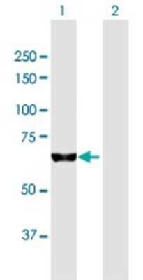 Western Blot: PUM3 Antibody [H00009933-B01P]