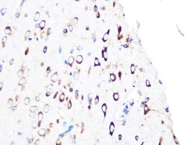 Immunohistochemistry-Paraffin: PUMA Antibody (9C5W5) [NBP3-16268]