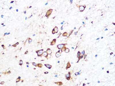 Immunohistochemistry-Paraffin: PUMA Antibody (9C5W5) [NBP3-16268]