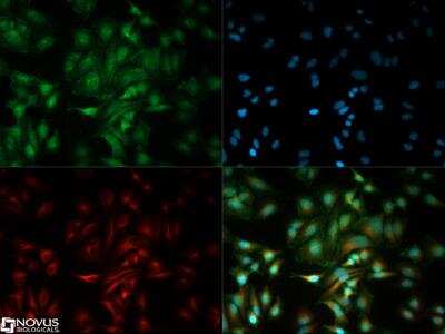 Immunocytochemistry/ Immunofluorescence: PUMA Antibody [NB500-261]