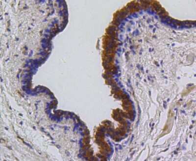 Immunohistochemistry-Paraffin: PUMA Antibody (SR42-09) [NBP2-67326]