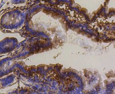 Immunohistochemistry-Paraffin: PUMA Antibody (SR42-09) [NBP2-67326]